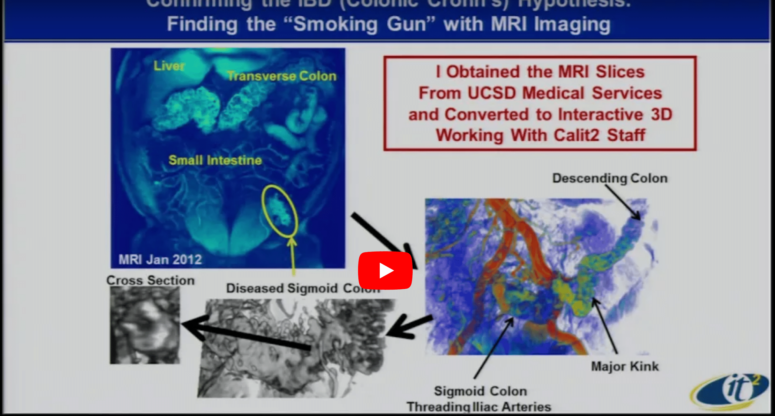 Machine Learning Opportunities in the Explosion of Personalized Precision Medicine