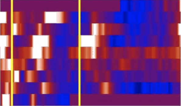 N-of-1 Experience in Personalized Lifestyle Medicine